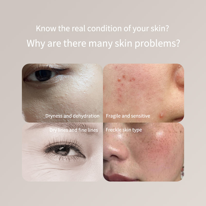 Skincare Only You - Penna portatile per tester della pelle