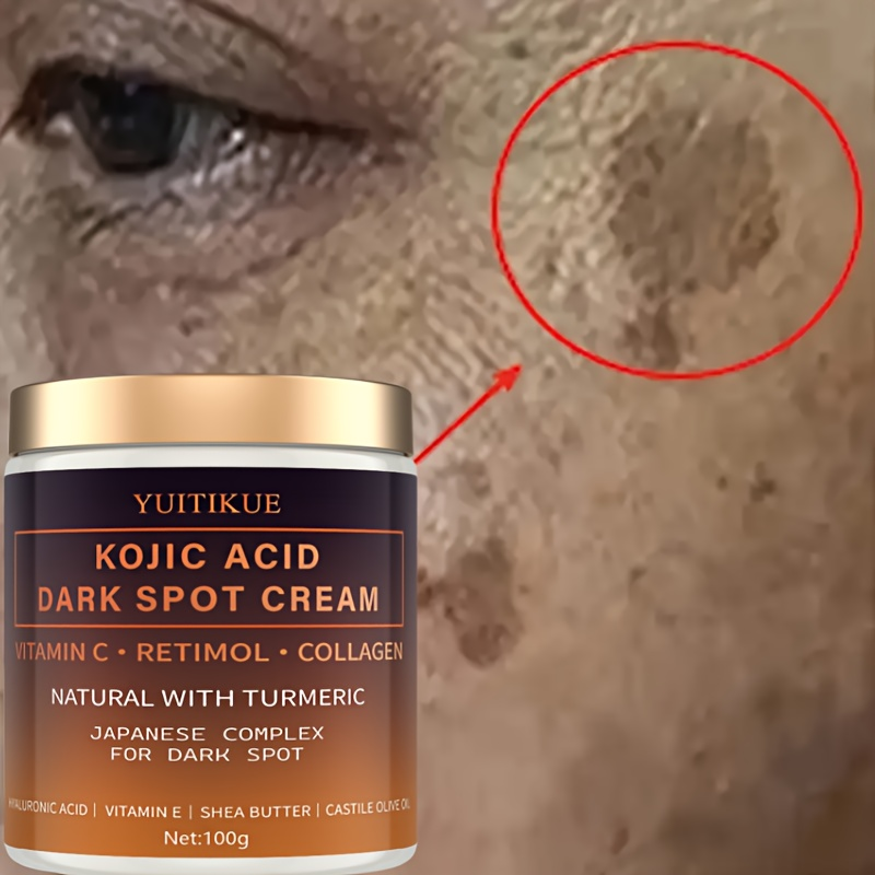 Retinol Vitamin A Cream - Crema sbiadita di arbutina, vitamina C,