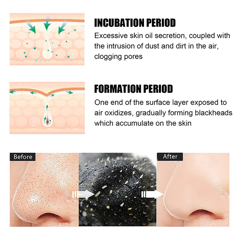 10/20/50/100PCS Naso Maschera  - Skincare Viral Tiktok recensione e prezzo