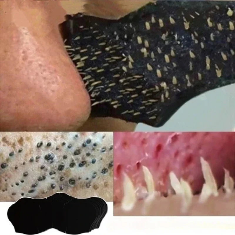 Maschera per la rimozione di p - Skincare Viral Tiktok recensione e prezzo
