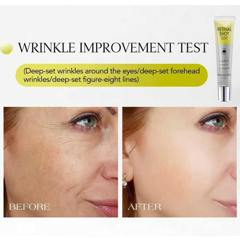 Siero Intensivo Retinale 0.1%  - Retinol Vitamin A Cream recensione e prezzo
